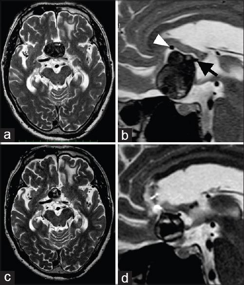 https://cdn.ncbi.nlm.nih.gov/pmc/blobs/724f/5234299/2b196e439c93/SNI-7-1069-g001.jpg