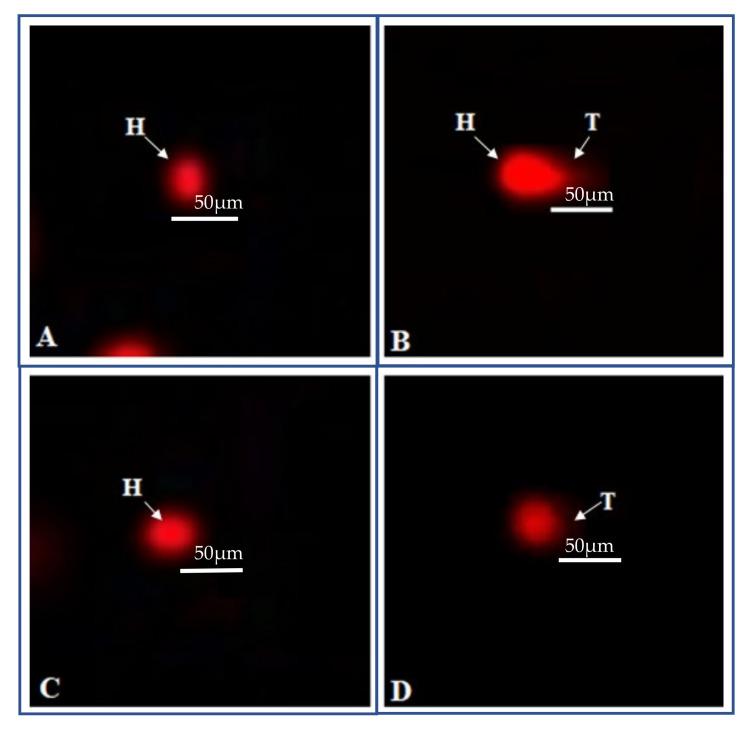https://cdn.ncbi.nlm.nih.gov/pmc/blobs/7253/8584265/0c7adece3905/ijms-22-11432-g007.jpg