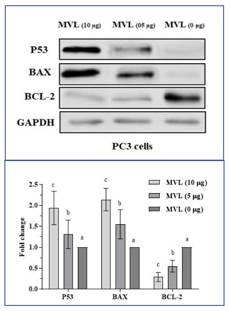 https://cdn.ncbi.nlm.nih.gov/pmc/blobs/7253/8584265/3126b81917bc/ijms-22-11432-g006.jpg