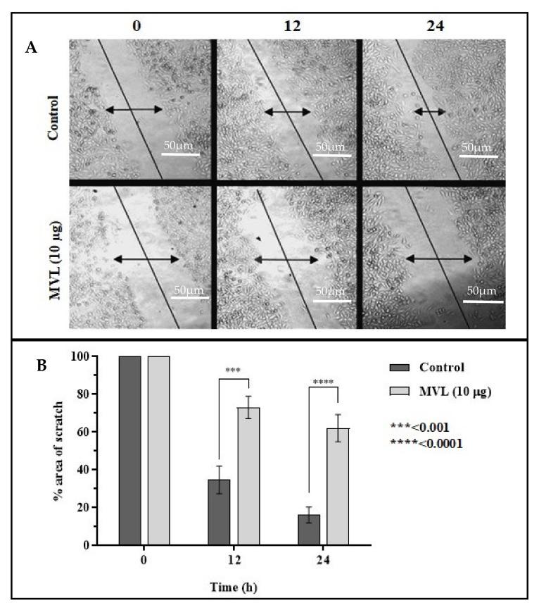 https://cdn.ncbi.nlm.nih.gov/pmc/blobs/7253/8584265/75af2d28f1a2/ijms-22-11432-g005.jpg