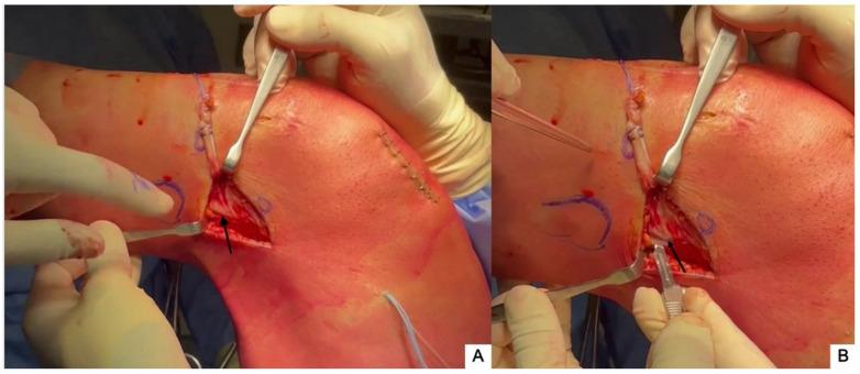 https://cdn.ncbi.nlm.nih.gov/pmc/blobs/7254/10816928/0369f75fca97/jcm-13-00377-g003.jpg
