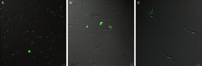 https://cdn.ncbi.nlm.nih.gov/pmc/blobs/7256/4858258/a3a76ba4f5c8/pone.0154489.g006.jpg