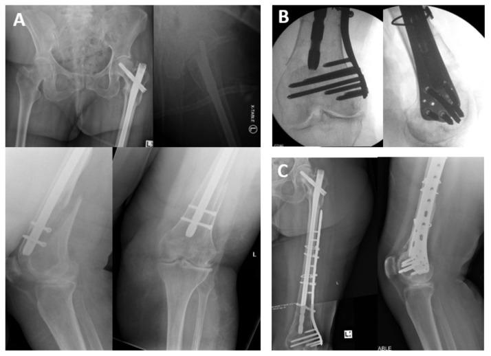 https://cdn.ncbi.nlm.nih.gov/pmc/blobs/725a/8066145/6a8bfb25fa0a/medicina-57-00338-g001.jpg