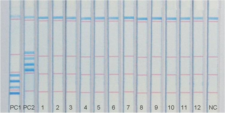 https://cdn.ncbi.nlm.nih.gov/pmc/blobs/725b/8326646/9fb3c679ff15/284_2021_2621_Fig4_HTML.jpg