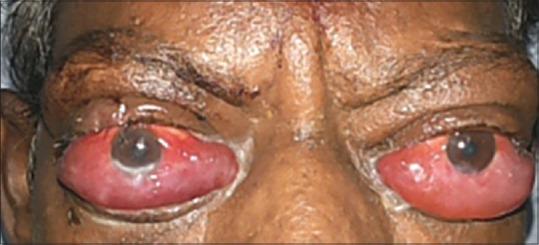 https://cdn.ncbi.nlm.nih.gov/pmc/blobs/725e/7508111/6bfa0dce0324/IJO-68-1127-g003.jpg