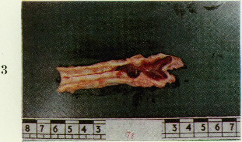 https://cdn.ncbi.nlm.nih.gov/pmc/blobs/725f/2093824/19837abbe6ee/brjexppathol00315-0056-c.jpg