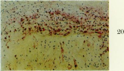 https://cdn.ncbi.nlm.nih.gov/pmc/blobs/725f/2093824/3585aeead8c8/brjexppathol00315-0058-h.jpg