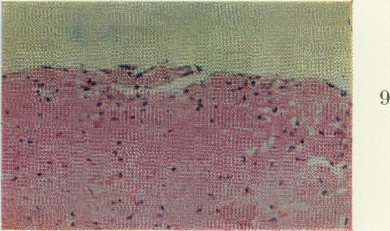 https://cdn.ncbi.nlm.nih.gov/pmc/blobs/725f/2093824/49f8021ec827/brjexppathol00315-0057-e.jpg
