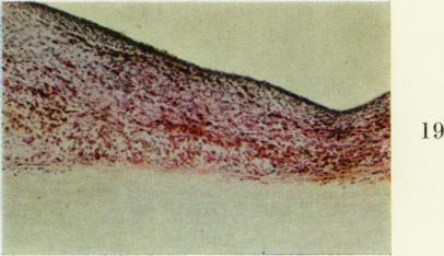 https://cdn.ncbi.nlm.nih.gov/pmc/blobs/725f/2093824/a54e65d7160c/brjexppathol00315-0058-g.jpg