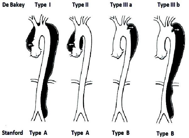 https://cdn.ncbi.nlm.nih.gov/pmc/blobs/7261/4228997/2d7ecd646108/PAMJ-17-196-g002.jpg
