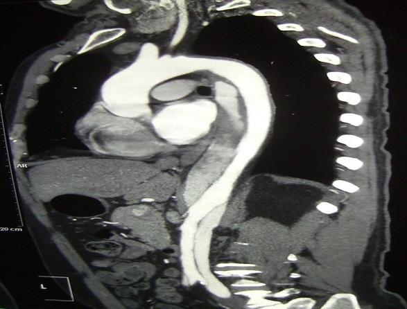 https://cdn.ncbi.nlm.nih.gov/pmc/blobs/7261/4228997/a80b7771a328/PAMJ-17-196-g001.jpg