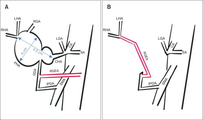 https://cdn.ncbi.nlm.nih.gov/pmc/blobs/7265/10063399/5e87e7709460/vsi-39-5-f4.jpg