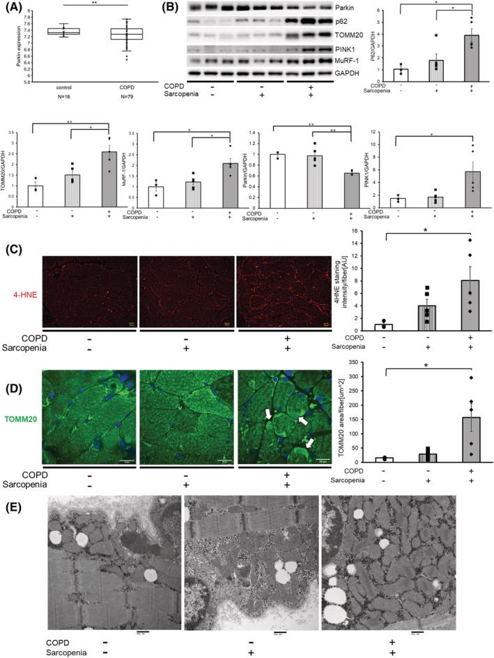 https://cdn.ncbi.nlm.nih.gov/pmc/blobs/7266/9178376/2d7adc7e6afc/JCSM-13-1864-g005.jpg