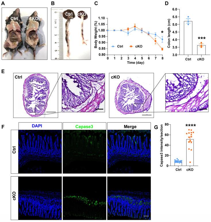 https://cdn.ncbi.nlm.nih.gov/pmc/blobs/7269/11545518/b523da16ccf2/cells-13-01784-g005.jpg