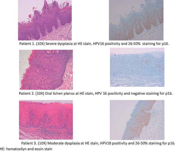 https://cdn.ncbi.nlm.nih.gov/pmc/blobs/726a/6335078/ecdd740c29f5/pone.0210070.g002.jpg