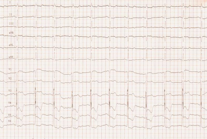 https://cdn.ncbi.nlm.nih.gov/pmc/blobs/726b/3539602/8582643bb0a6/medscimonit-17-8-RA191-g003.jpg