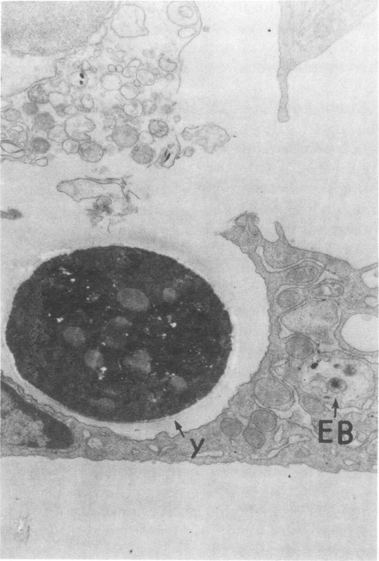 https://cdn.ncbi.nlm.nih.gov/pmc/blobs/726e/351526/f9106a7a29a9/iai00163-0490-b.jpg