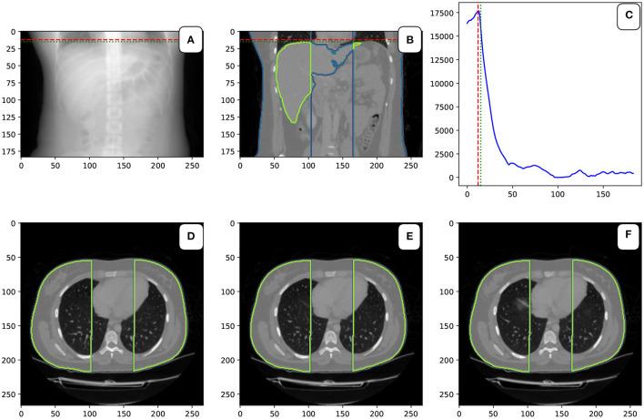 https://cdn.ncbi.nlm.nih.gov/pmc/blobs/726e/8518428/26c9ce3c4b1e/fphys-12-734217-g0004.jpg