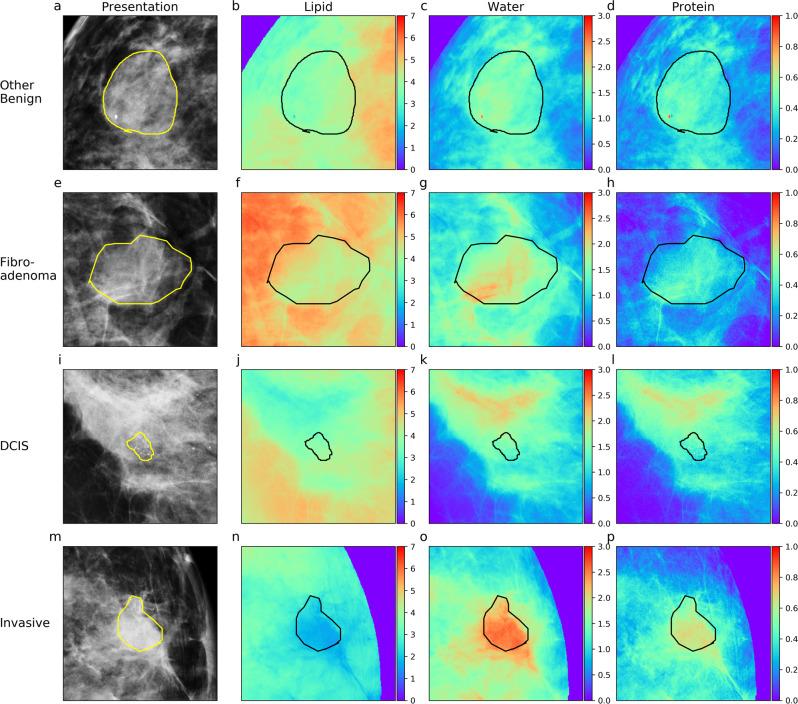https://cdn.ncbi.nlm.nih.gov/pmc/blobs/7271/9053198/ee0798075933/43856_2021_24_Fig4_HTML.jpg