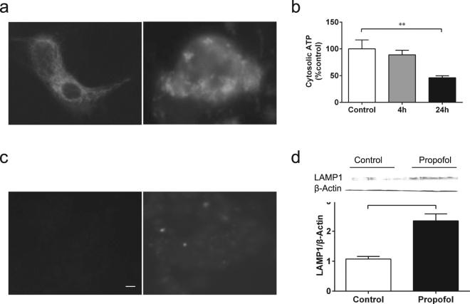 https://cdn.ncbi.nlm.nih.gov/pmc/blobs/7277/5620053/82a83fcf106a/41598_2017_11607_Fig5_HTML.jpg