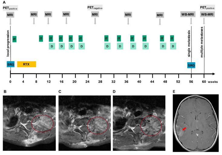 https://cdn.ncbi.nlm.nih.gov/pmc/blobs/7279/7866294/5824c5717705/cancers-13-00520-g006.jpg