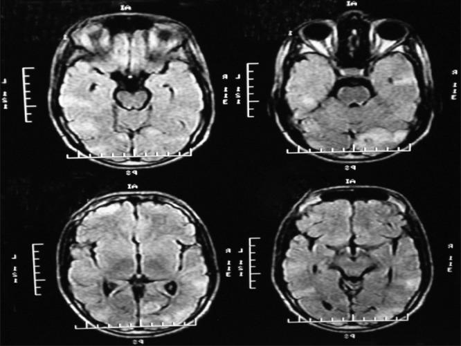 https://cdn.ncbi.nlm.nih.gov/pmc/blobs/727e/3830165/4319a695c8c2/IPJ-21-148-g003.jpg