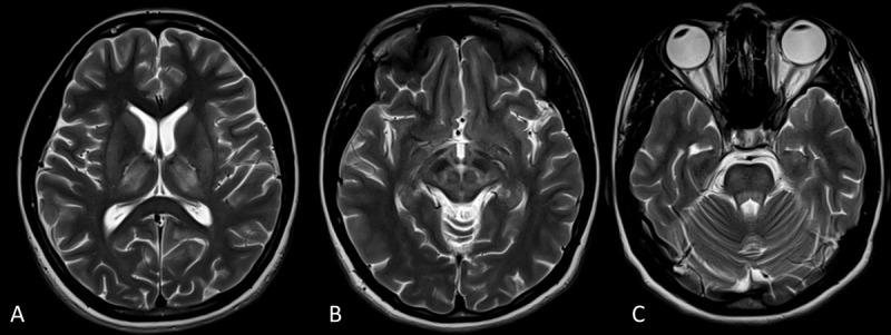https://cdn.ncbi.nlm.nih.gov/pmc/blobs/7286/12063596/372faac07457/tohm-15-1-938-g2.jpg