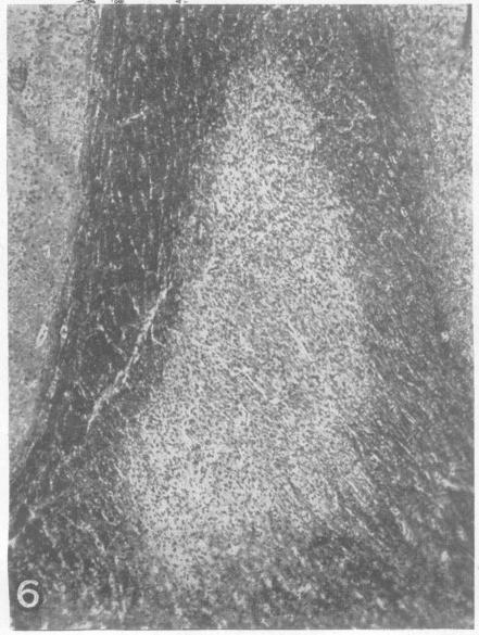 https://cdn.ncbi.nlm.nih.gov/pmc/blobs/7286/498593/6805f8a16197/jnnpsyc00313-0007-c.jpg