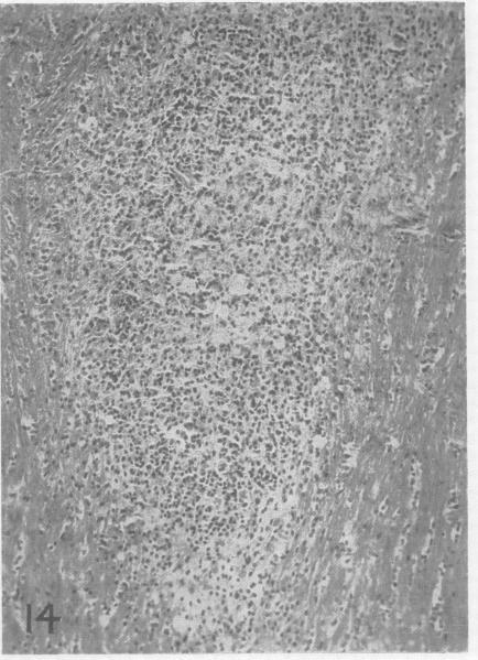 https://cdn.ncbi.nlm.nih.gov/pmc/blobs/7286/498593/a63ff9700621/jnnpsyc00313-0010-a.jpg