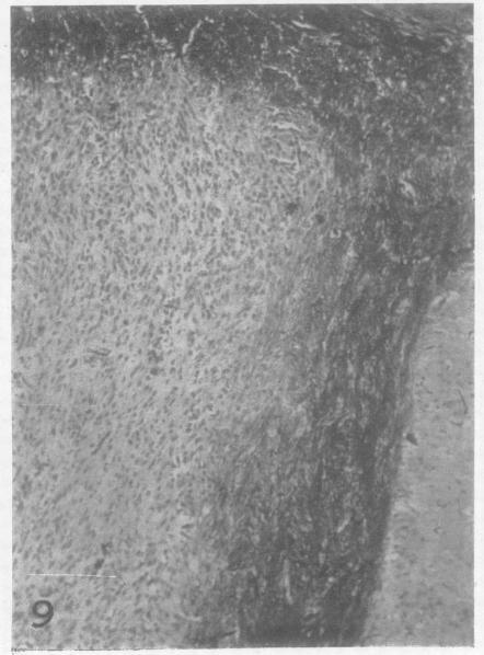 https://cdn.ncbi.nlm.nih.gov/pmc/blobs/7286/498593/e1c61da318b1/jnnpsyc00313-0008-c.jpg