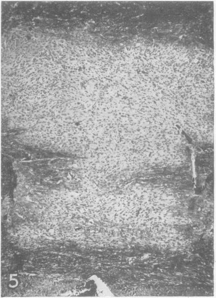 https://cdn.ncbi.nlm.nih.gov/pmc/blobs/7286/498593/fc9b04804e42/jnnpsyc00313-0007-b.jpg