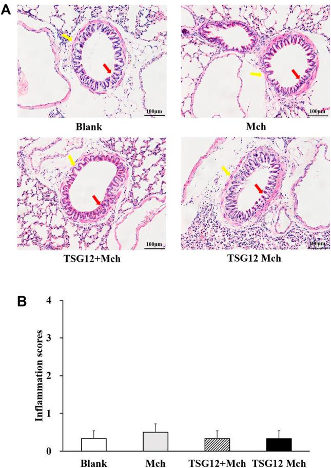 https://cdn.ncbi.nlm.nih.gov/pmc/blobs/728f/9243334/a4a5726a9582/fphar-13-873612-g003.jpg