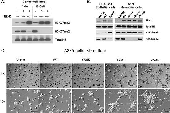 https://cdn.ncbi.nlm.nih.gov/pmc/blobs/7292/4413628/6903929a2c97/oncotarget-06-2928-g001.jpg