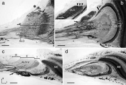 https://cdn.ncbi.nlm.nih.gov/pmc/blobs/7298/5435961/6e428a3a0aa4/CNE-525-2343-g007.jpg
