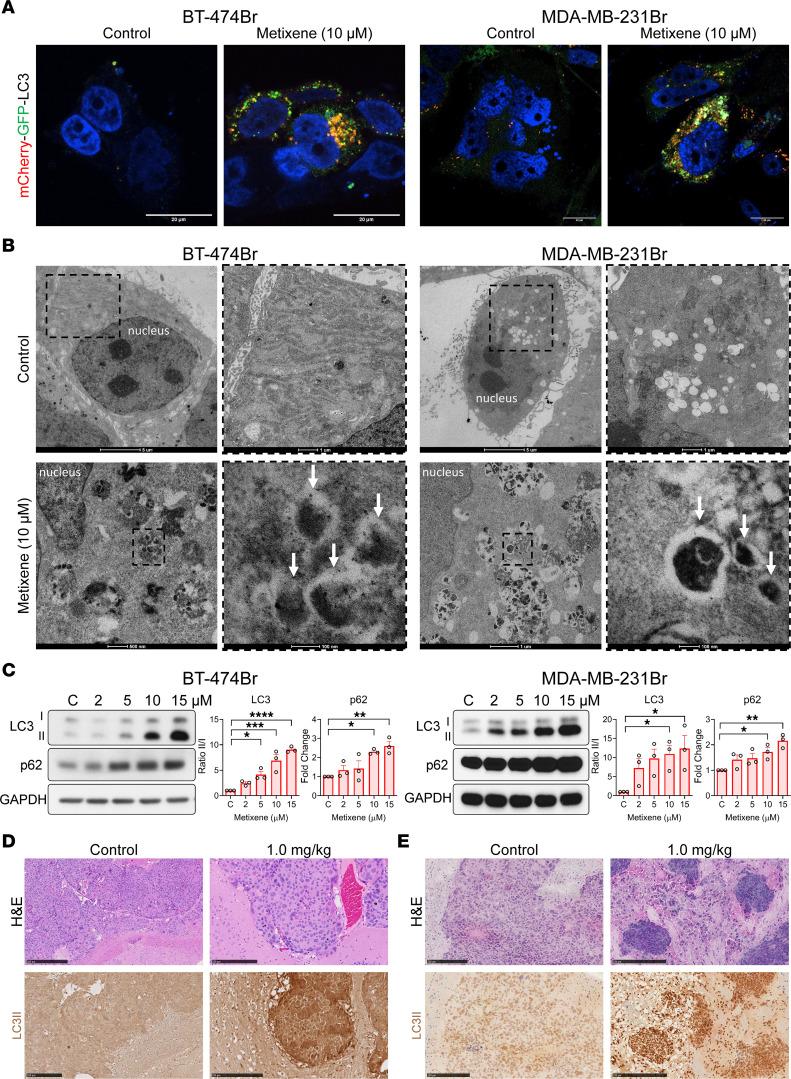 https://cdn.ncbi.nlm.nih.gov/pmc/blobs/7299/10721147/de1e81c29b7f/jci-133-161142-g048.jpg