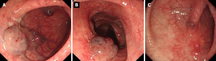 https://cdn.ncbi.nlm.nih.gov/pmc/blobs/729a/10989353/33194a0d15bc/WJGS-16-966-g005.jpg
