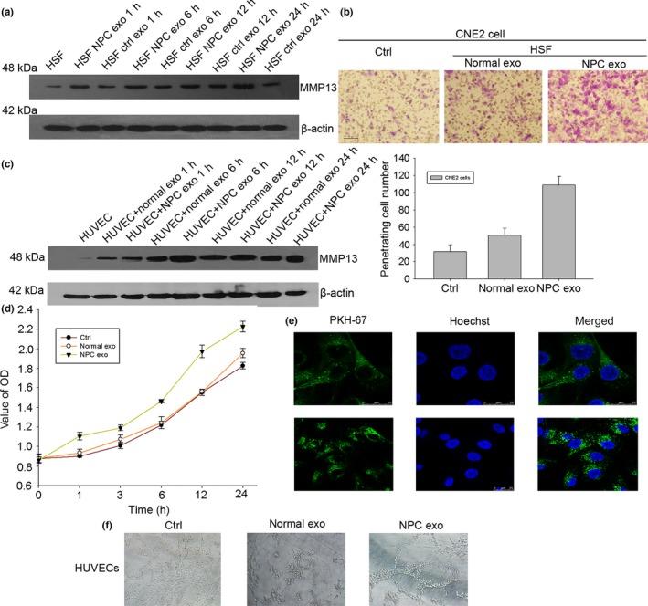 https://cdn.ncbi.nlm.nih.gov/pmc/blobs/729a/4714673/499963b2a743/CAS-106-00000000001669-g002.jpg