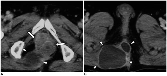 https://cdn.ncbi.nlm.nih.gov/pmc/blobs/729e/2827785/4fa95d4d28d5/kjr-11-211-g007.jpg