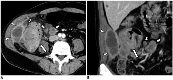 https://cdn.ncbi.nlm.nih.gov/pmc/blobs/729e/2827785/5e23609ffc07/kjr-11-211-g005.jpg