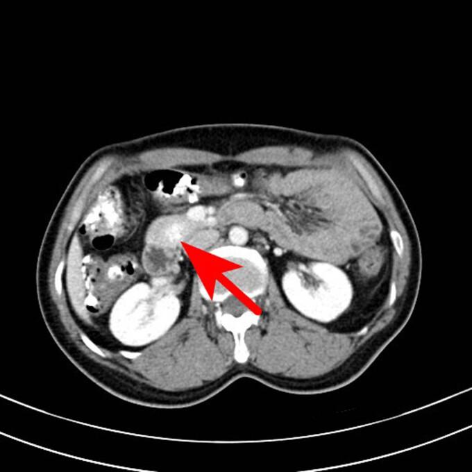https://cdn.ncbi.nlm.nih.gov/pmc/blobs/729f/10628574/979edb0c98ae/j_biol-2022-0742-fig005.jpg
