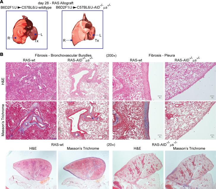 https://cdn.ncbi.nlm.nih.gov/pmc/blobs/72a5/7714414/d6eae83cc8be/jciinsight-5-136533-g107.jpg