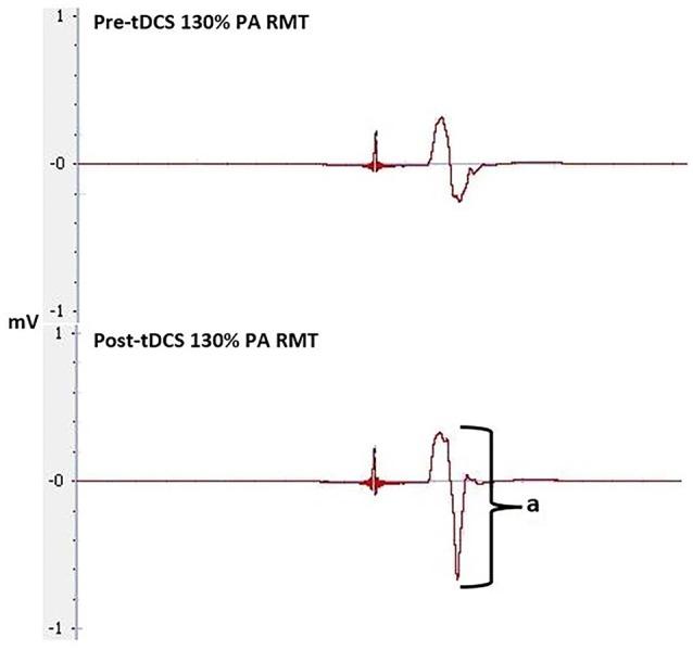 https://cdn.ncbi.nlm.nih.gov/pmc/blobs/72aa/5052268/01b254bf3251/fnhum-10-00487-g0009.jpg