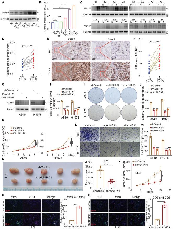 https://cdn.ncbi.nlm.nih.gov/pmc/blobs/72ad/11324481/a11c97a5a277/fimmu-15-1430171-g007.jpg