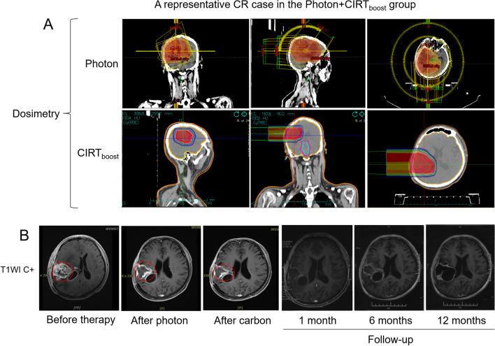 https://cdn.ncbi.nlm.nih.gov/pmc/blobs/72b6/11245814/55a07b503755/12885_2024_12606_Fig6_HTML.jpg
