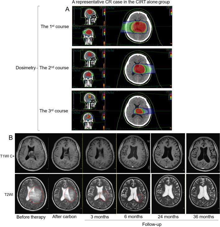 https://cdn.ncbi.nlm.nih.gov/pmc/blobs/72b6/11245814/d3e0b629d1dd/12885_2024_12606_Fig5_HTML.jpg