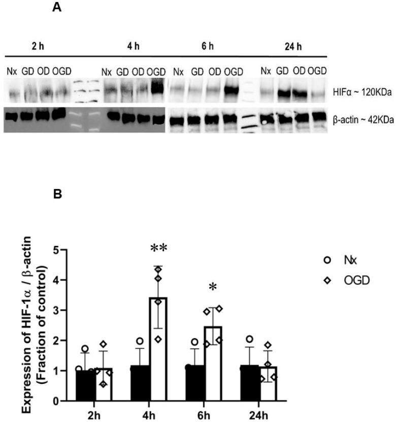https://cdn.ncbi.nlm.nih.gov/pmc/blobs/72bb/10138834/e6c104105380/ijms-24-07106-g004.jpg