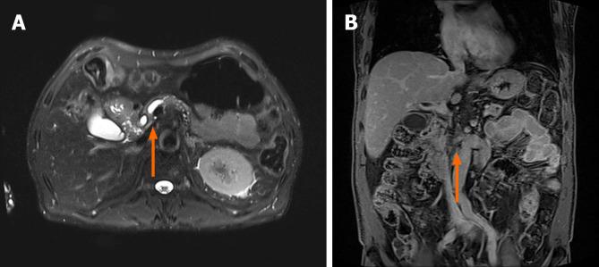 https://cdn.ncbi.nlm.nih.gov/pmc/blobs/72bb/10989431/e3b9650b4451/WJCC-12-1677-g002.jpg
