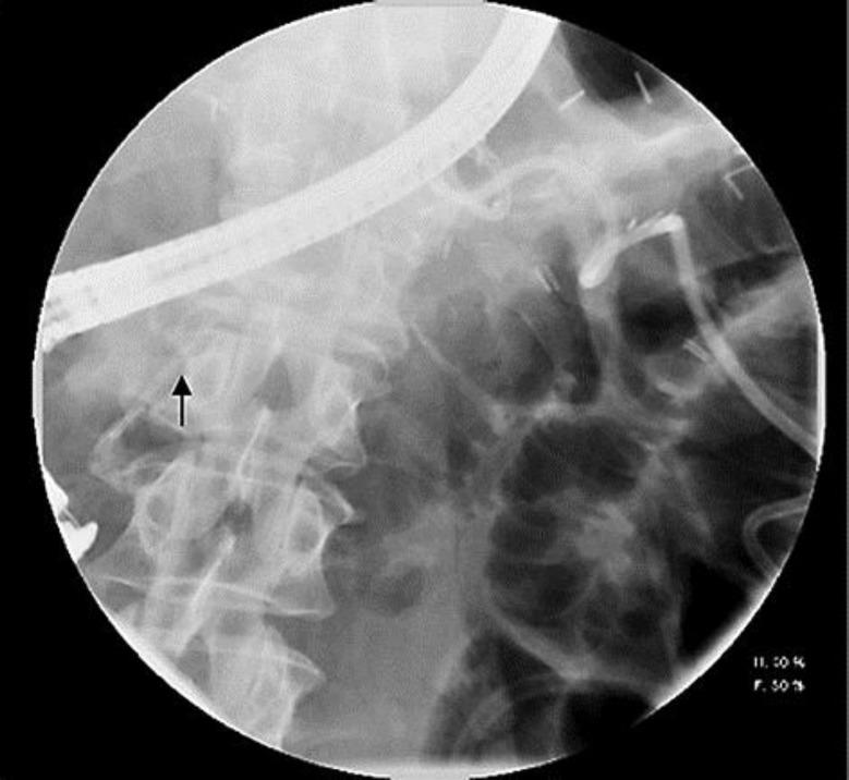 https://cdn.ncbi.nlm.nih.gov/pmc/blobs/72bc/3764947/09a894f5070d/crg-0007-0332-g02.jpg