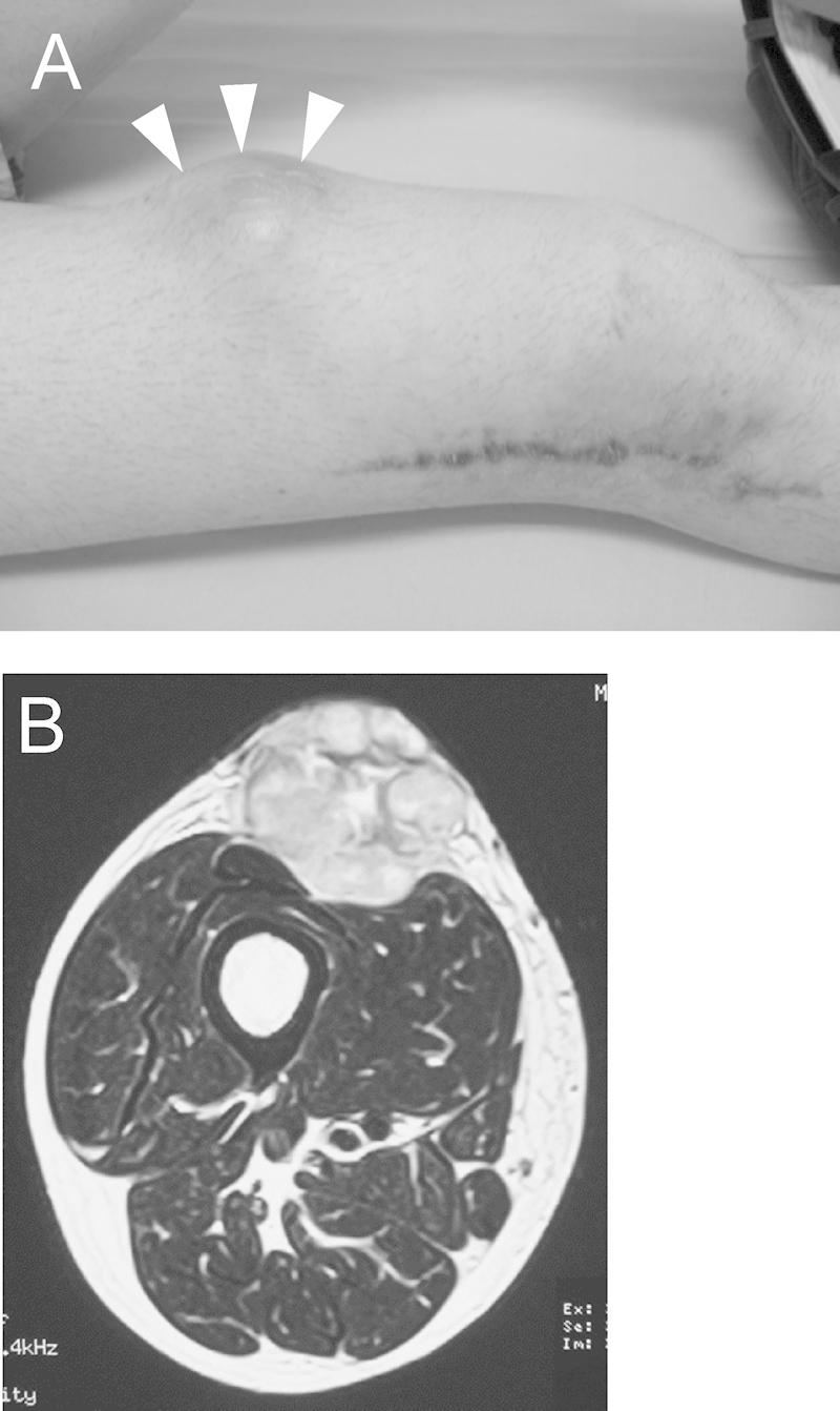 https://cdn.ncbi.nlm.nih.gov/pmc/blobs/72c1/4802299/a6c92ccfa3b1/gr4.jpg