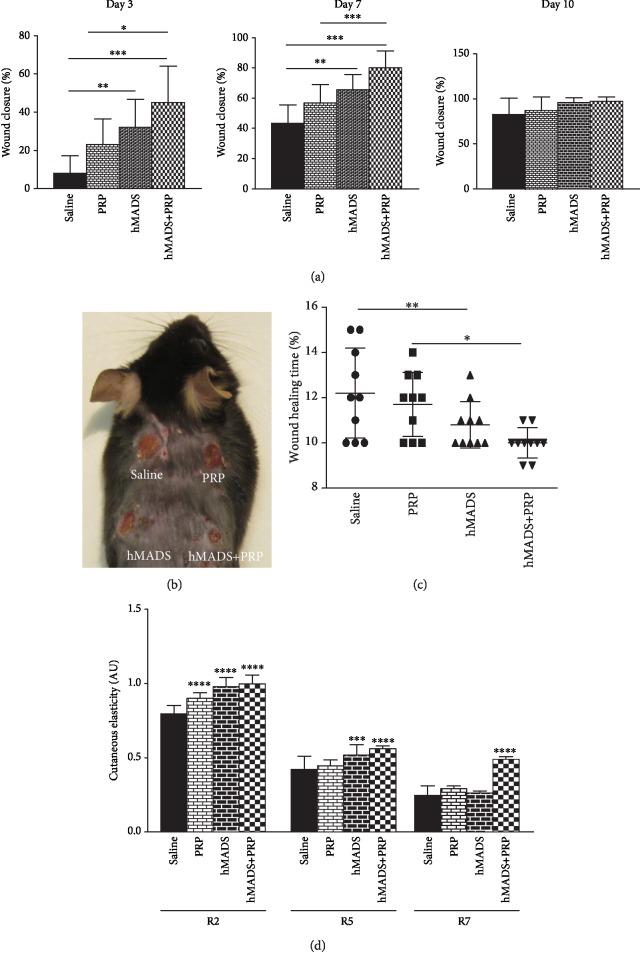 https://cdn.ncbi.nlm.nih.gov/pmc/blobs/72c4/6875194/0f95873d8c4d/SCI2019-1234263.001.jpg